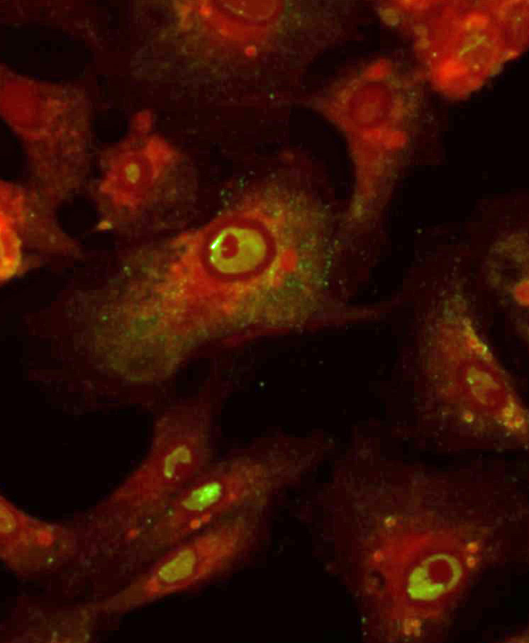 Direct and Indirect Powassan Virus Testing Coppe Laboratories